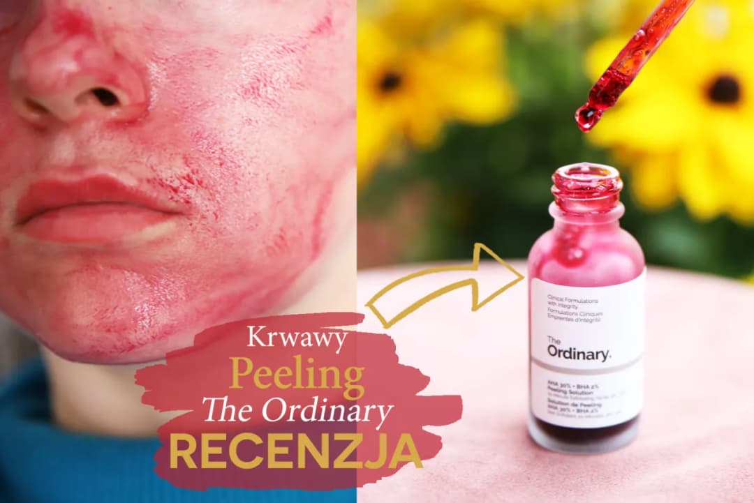 Jak bezpiecznie używać The Ordinary Krwawe Peeling? Instrukcja krok po kroku i ważne wskazówki