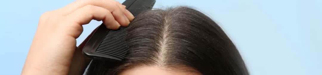 Jak nakładać peeling na skórę głowy, by uniknąć podrażnień i zyskać zdrowe włosy